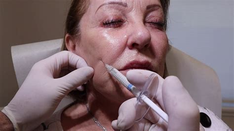 granny gets filler and botox youtube