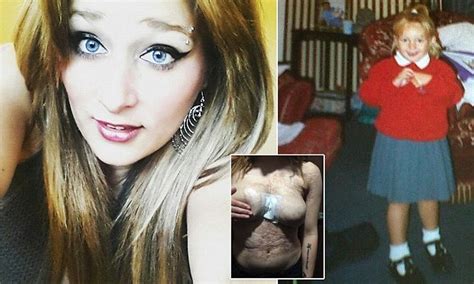 Ashleigh Lovric Has Deformed Breasts After Turning Into A Human