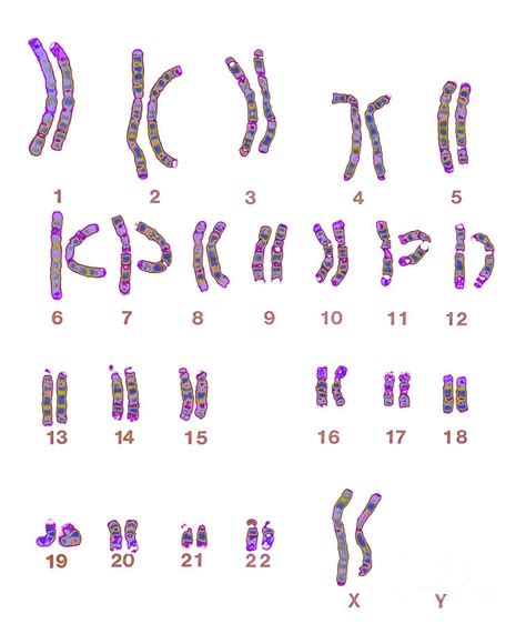 Kromosom Yang Normal Hot Sex Picture