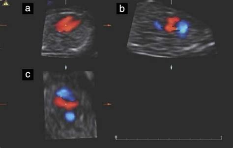 Standardization Of The First‐trimester Fetal Cardiac Examination Using