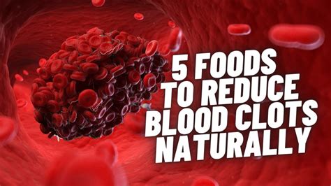 5 Foods That Reduce Blood Clots Health And Fitness Youtube