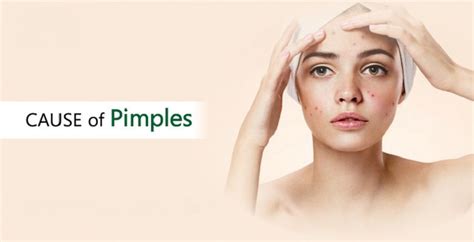 Most Common Causes And Different Types Of Pimples Healthy Flat