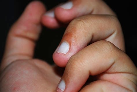 New Study Reveals Nail Biting Isnt A Nervous Habit But A Sign Of A