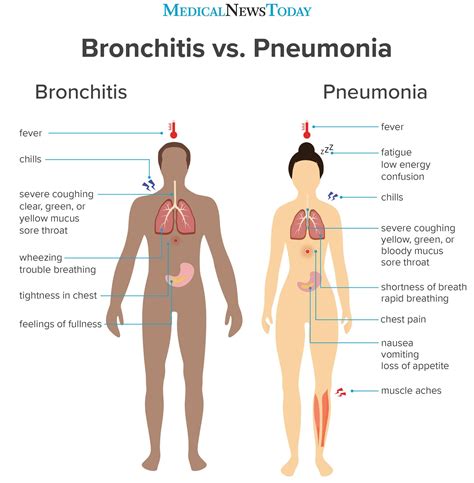 Bronchitis Vs Pneumonia How To Tell Medical Knowledge Medical
