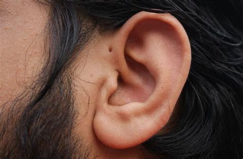 How To Remove Preauricular Skin Tags All Things Health