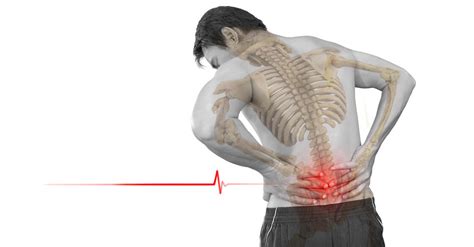 Can Cryotherapy Help with Chronic Back Pain? - San Diego Cryotherapy