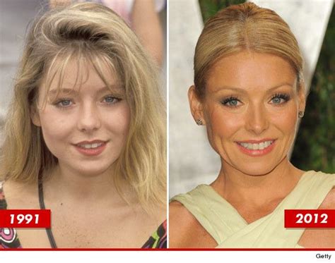 Kelly Ripa Before And After Botox