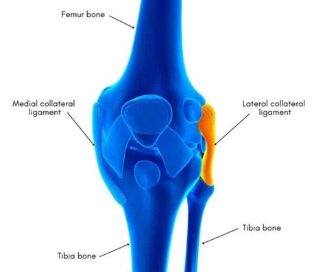 Lcl Injury Recovery Lateral Collateral Ligament Injury