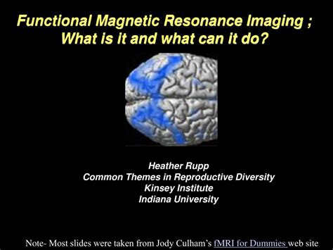 Ppt Functional Magnetic Resonance Imaging What Is It And What Can