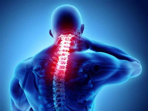 Cervical Kyphosis Causes Symptoms And Treatment Spinal Back Rack