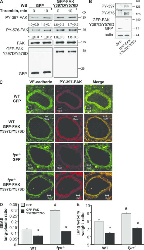 Transduction Of Phosphorylation Mimicking Fak Mutant Rescues Lung