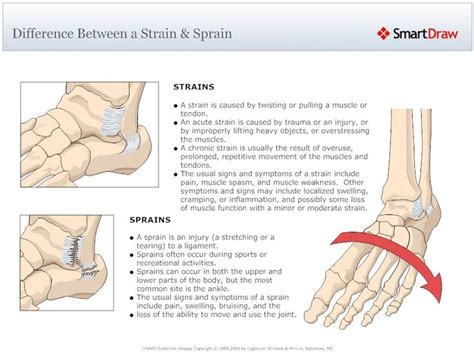 Pin on #Orthopaedic Diagrams by SmartDraw
