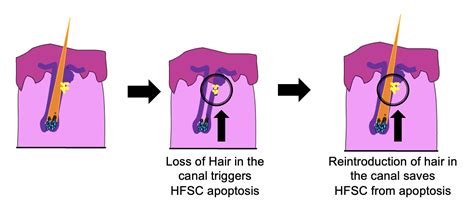 An Unexpected Surprise Hair Follicle Stem Cells HFSCs Like Having