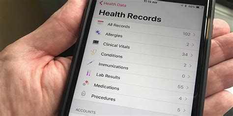 Apple Iphone Contains Medical Records Upstate News Suny Upstate