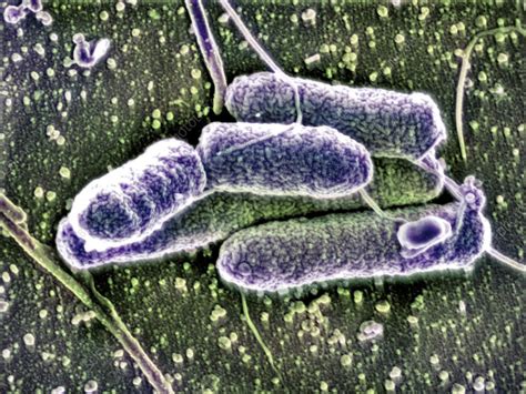 Pseudomonas Bacteria Sem Stock Image C0148295 Science Photo Library