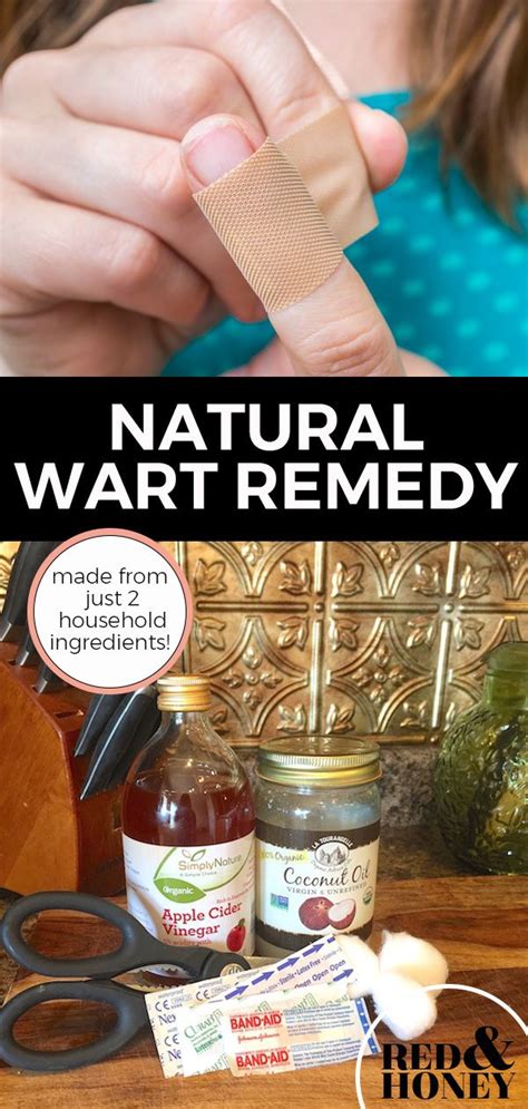 Natural Wart Remedy Just 2 Household Ingredients Natural Wart