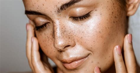 What Are The Most Common Skin Problems
