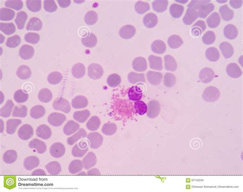 The Presence Of Eosinophils In These Latter Organs Stock Photo Image