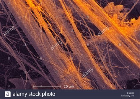 Scanning Electron Micrograph Of Asbestos 1200x Stock Photo Alamy