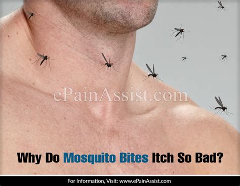 Why Do Mosquito Bites Itch So Bad
