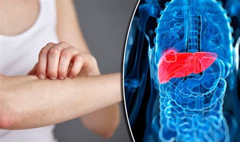 11 Signs That Your Body Sends You To Tell You That Your Liver Is Sick