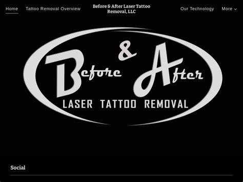 Want to know more about how to start tattoo removal business? Start A Tattoo Removal Business - Business Ideas