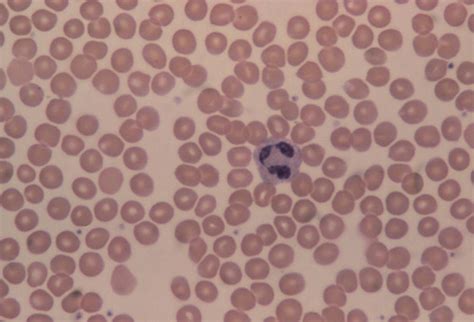 Lm Of Human Blood Smear Showing Red And White Cells Photograph By Dr E