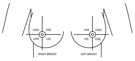 Breasts, or mammary glands, are capable of producing milk in females. Breast quadrants definition: Upper-Outer (UOQ), Upper ...