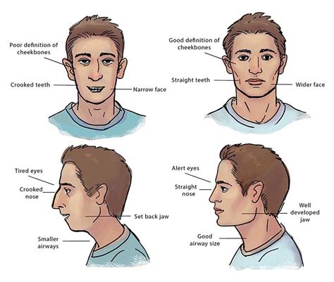 How To Mew Properly Tsmp Medical Blog