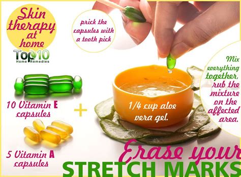 How To Get Rid Of Stretch Marks Fast Top 10 Home Remedies