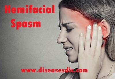 Hemifacial Spasm Types Causes And Symptoms
