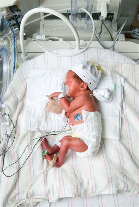 Can Ob Nurse Practitioners Deliver Babies Drucilla Schweitzer