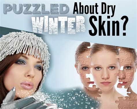Puzzled About Dry Winter Skin Well Valentia May Have Your Answer
