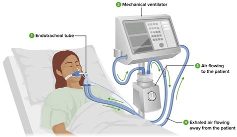 El Cuerpo Humano Mecanismos Respiratorios Ventilación Mecánica Y