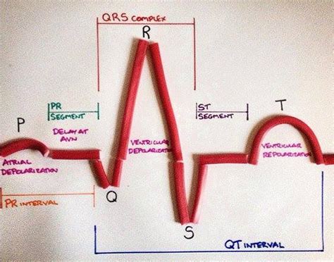 Medical Laboratory And Biomedical Science 10 Steps To Learn Ecg