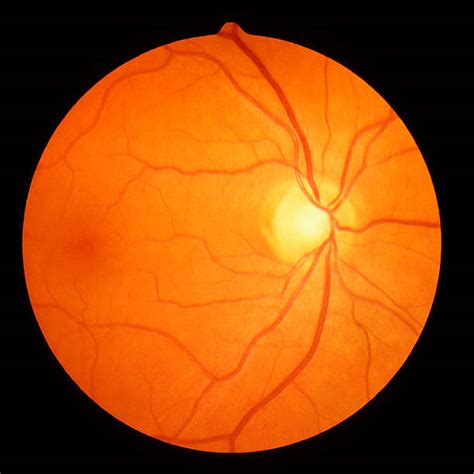 3100 Fundus Stock Photos Pictures And Royalty Free Images Istock