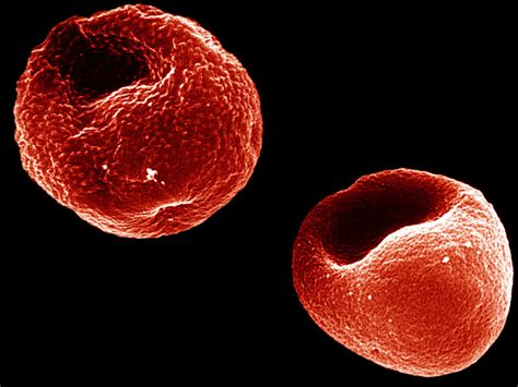 Gametocytes, which are transmitted to anopheles vectors during blood. Research News: Molecule Allows Malaria Parasite to ...