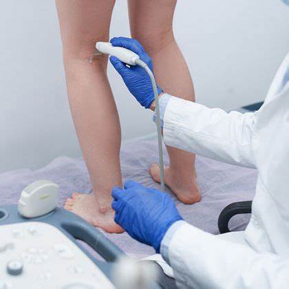 ᐉ Варикоз: симптомы, причины — Стадии варикозного расширения вен Картинка - ᐉ Варикоз: симптомы, причины — Стадии варикозного расширения вен