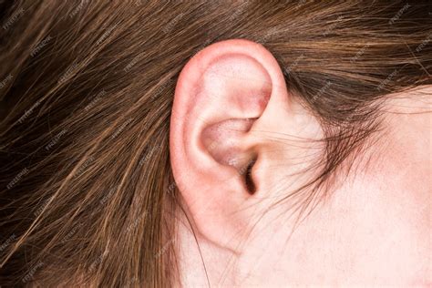 Premium Photo Acne Inside The Female Ear