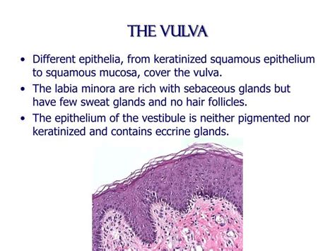 Ppt Benign Diseases Of The Vulva Vagina And Cervix Powerpoint
