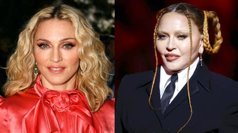 What Did Madonna Do To Her Face Her Before And After Photo Explained
