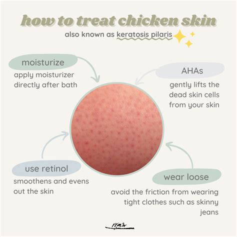 What Is Keratosis Pilaris Aka Chicken Skin Or Strawberry Skin🤔 💁‍♀