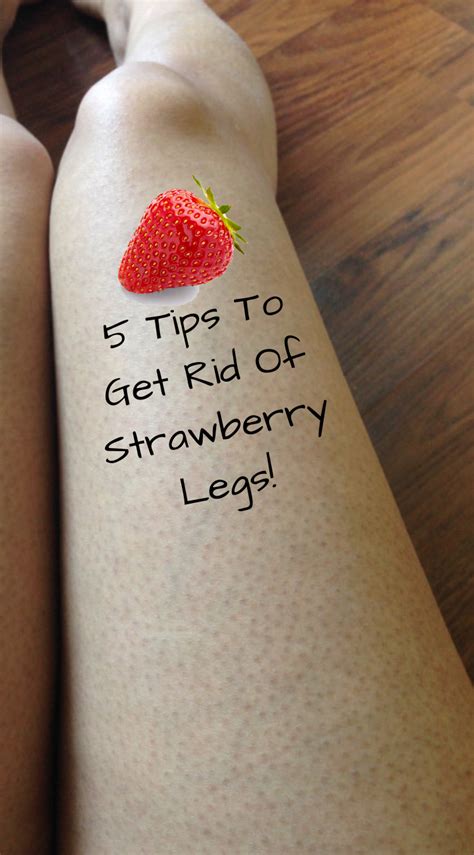 5 Tips To Get Rid Of Strawberry Legs How To Do Easy