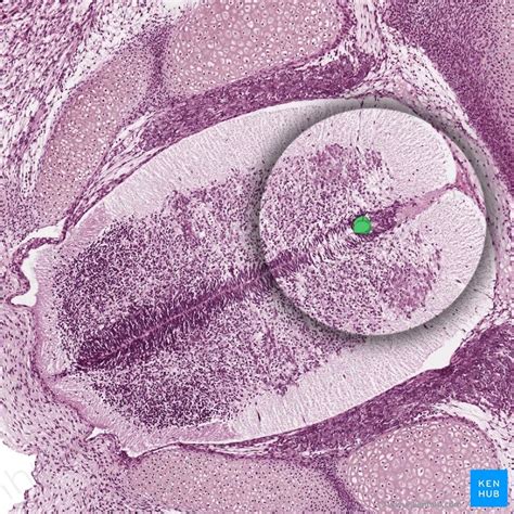 It is situated inside the vertebral canal of the vertebral column. Central canal of spinal cord (Canalis centralis medullae ...