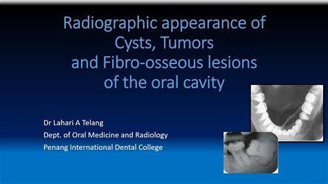 Radiographic Appearance Of Cysts Tumors And Fibro Osseous Lesions Of