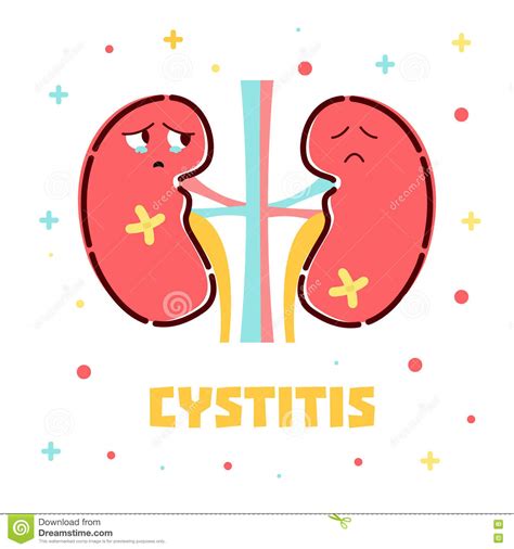 Cystitis Kidneys Poster Stock Vector Illustration Of Kidney 82169433
