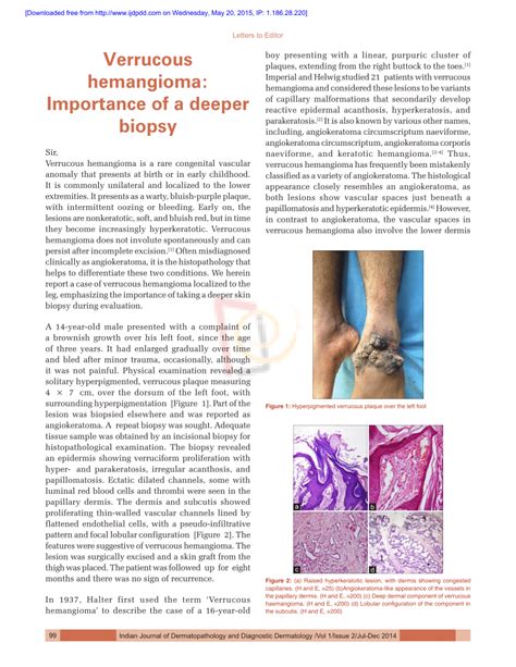 Pdf Verrucous Hemangioma Importance Of A Deeper Biopsy