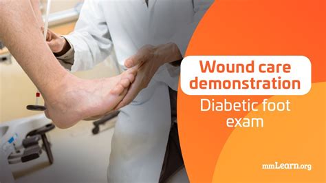Wound Care Demonstration Diabetic Foot Exam Youtube