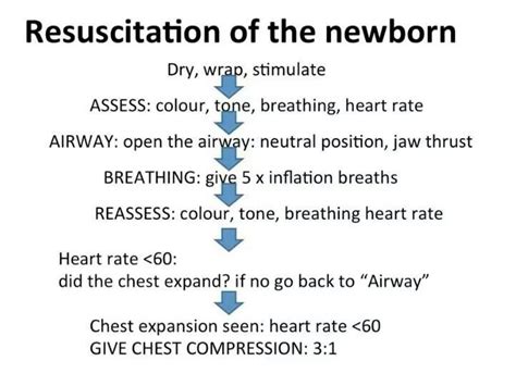 Neonatal Resuscitation Flow Chart Nice Laminated Copy Midwifery