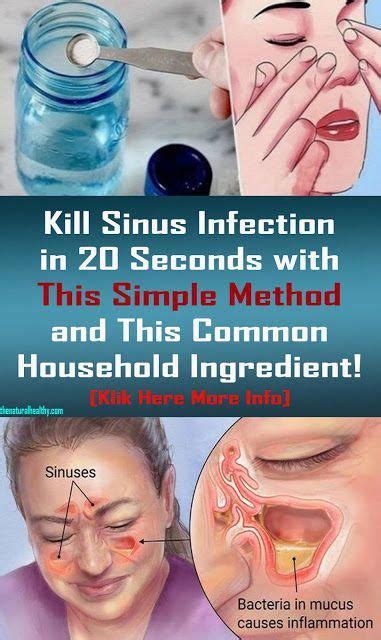 Kill Sinus Infection In 20 Seconds With This Simple Method And This